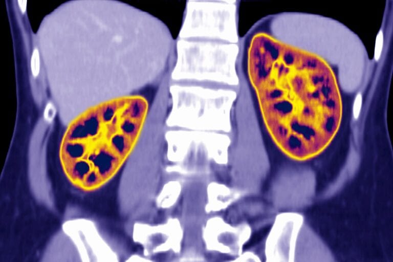 Resim 10: business kidney - Bir algoritma siyah hastaların böbrek naklini nasıl engelledi business kidney - Bir algoritma siyah hastaların böbrek naklini nasıl engelledi - 9